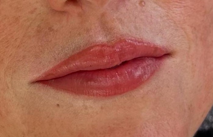 Lippenpigmentierung mit softer Kontur und gleichmäßigem Farbverlauf – nachher