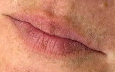 Natürliche Lippenpigmentierung – definierte Kontur und typgerechte Vollschattierung – vorher